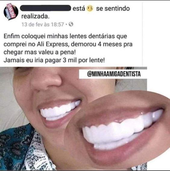 Memes engraçados lentes dentárias do Ali Express